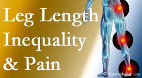 Aaron Chiropractic Clinic tests for leg length inequality as it is related to back, hip and knee pain issues.