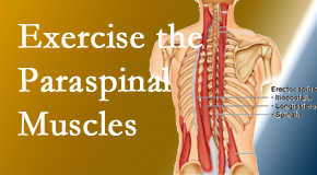 Aaron Chiropractic Clinic explains the importance of paraspinal muscles and their strength for Fort Wayne back pain relief.