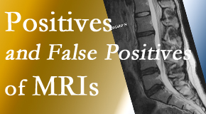 Aaron Chiropractic Clinic carefully chooses when and if MRI images are needed to guide the Fort Wayne chiropractic treatment plan. 