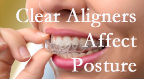 Clear aligners influence posture which Fort Wayne chiropractic helps.