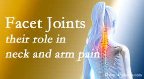 Aaron Chiropractic Clinic carefully examines, diagnoses, and treats cervical spine facet joints for neck pain relief when they are involved.