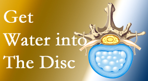 Aaron Chiropractic Clinic uses spinal manipulation and exercise to boost the diffusion of water into the disc which supports the health of the disc.