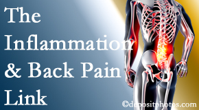 Aaron Chiropractic Clinic tackles the inflammatory process that accompanies back pain as well as the pain itself.