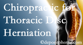 Aaron Chiropractic Clinic diagnoses and manages thoracic disc herniation pain and relieves its symptoms like unexplained abdominal pain or other gastrointestinal issues. 