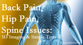 Aaron Chiropractic Clinic examines back pain patients for various issues like back pain and hip pain and other spine issues with imaging and clinical tests that influence a relieving chiropractic treatment plan.