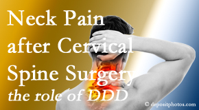 Aaron Chiropractic Clinic offers gentle care for neck pain after neck surgery.