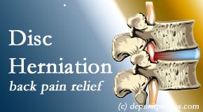 Aaron Chiropractic Clinic uses non-surgical treatment for relief of disc herniation related back pain. 