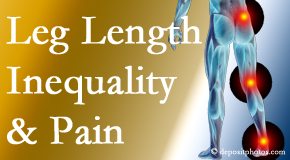 Aaron Chiropractic Clinic tests for leg length inequality as it is related to back, hip and knee pain issues.