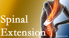 Aaron Chiropractic Clinic knows the role of extension in spinal motion, its necessity, its benefits and potential harmful effects. 