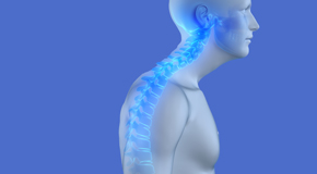 relief of Fort Wayne kyphosis pain