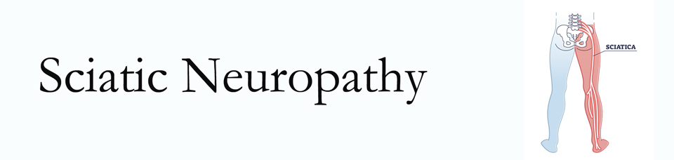 Fort Wayne neuropathy pain (sciatica) 