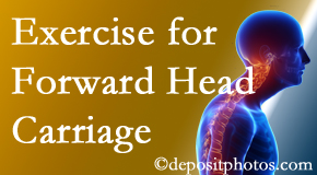 Fort Wayne chiropractic treatment of forward head carriage is two-fold: manipulation and exercise.