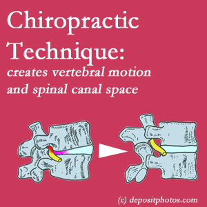 image of a Fort Wayne spinal stenotic canal