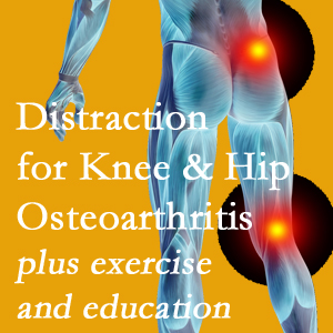 A chiropractic treatment plan for Fort Wayne knee pain and hip pain caused by osteoarthritis: education, exercise, distraction.