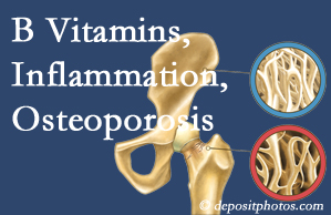 Fort Wayne chiropractic care of osteoporosis usually comes with nutritional tips like b vitamins for inflammation reduction and for prevention.
