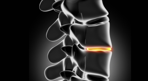 Fort Wayne chiropractic nutrition with vitamin D and quercitrin