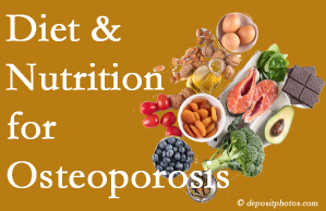 Fort Wayne osteoporosis prevention tips from your chiropractor include improved diet and nutrition and decreased sodium, bad fats, and sugar intake. 