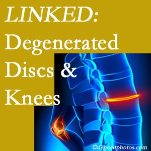Degenerated discs and degenerated knees are not such unlikely companions. They are seen to be related. Fort Wayne patients with a loss of disc height due to disc degeneration often also have knee pain related to degeneration.  