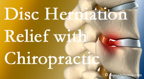 Aaron Chiropractic Clinic gently treats the disc herniation causing back pain. 
